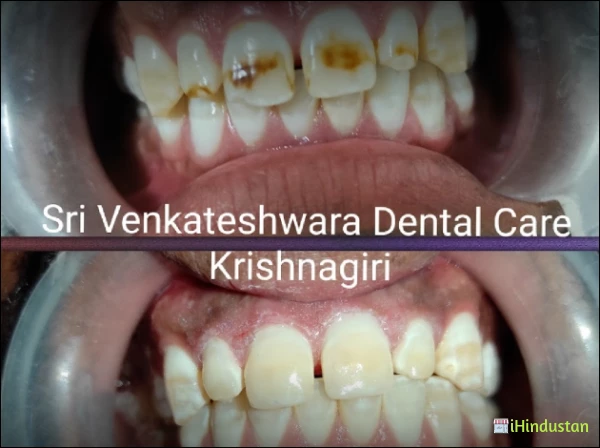Sri Venkateshwara Dental Care - Logo