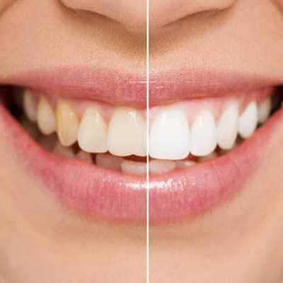 Sri Vinayaga Dental - Cover photo