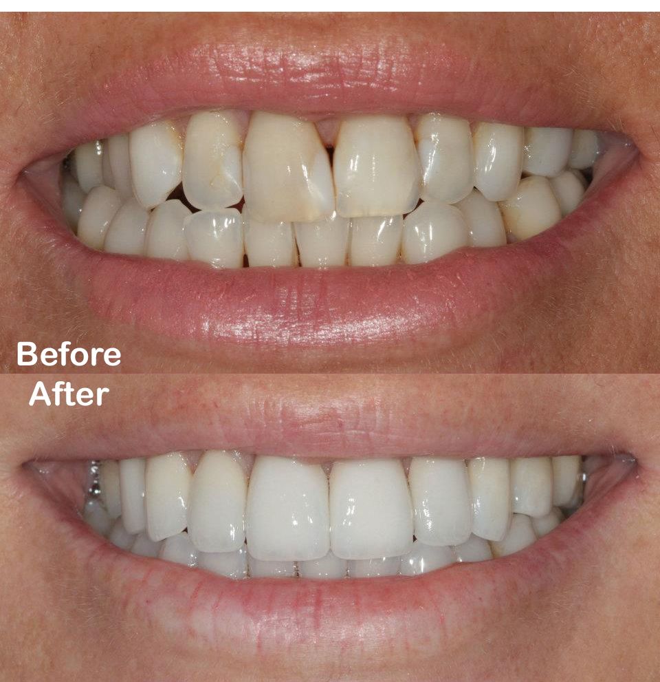 Start Smiling Dentisrty - Logo