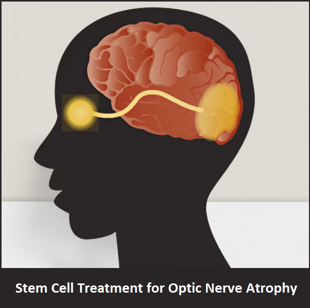 Stem Cell Therapy Center - Cover photo