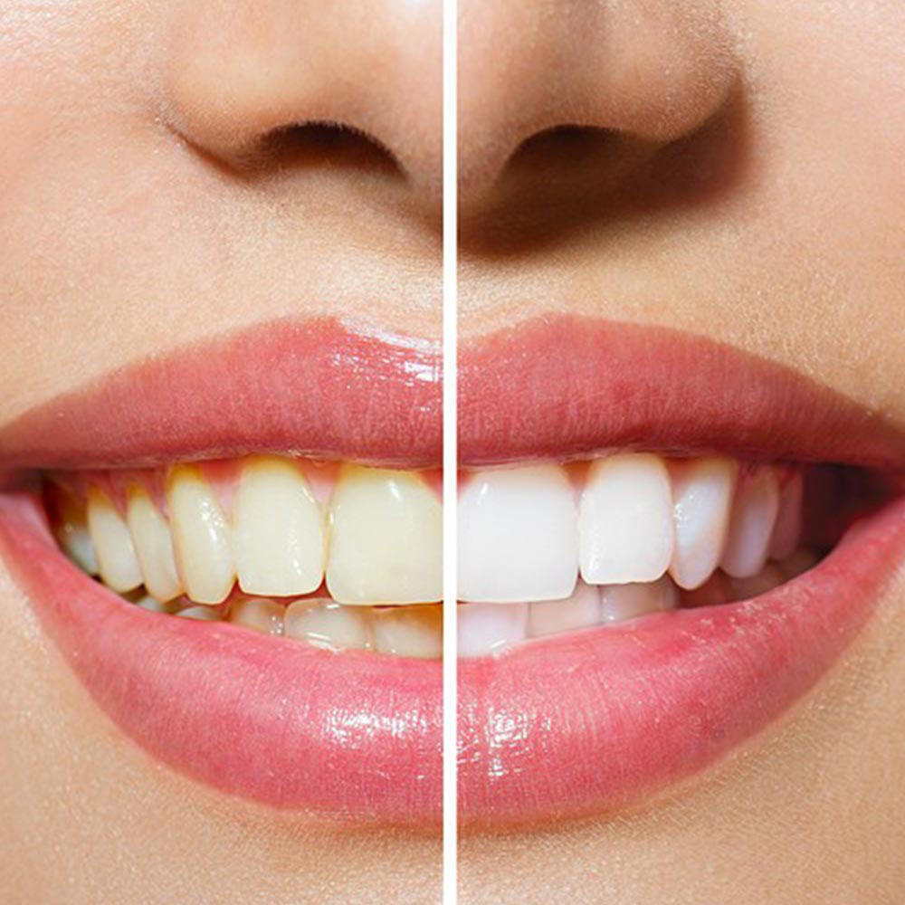 Suncoast Dental - Logo