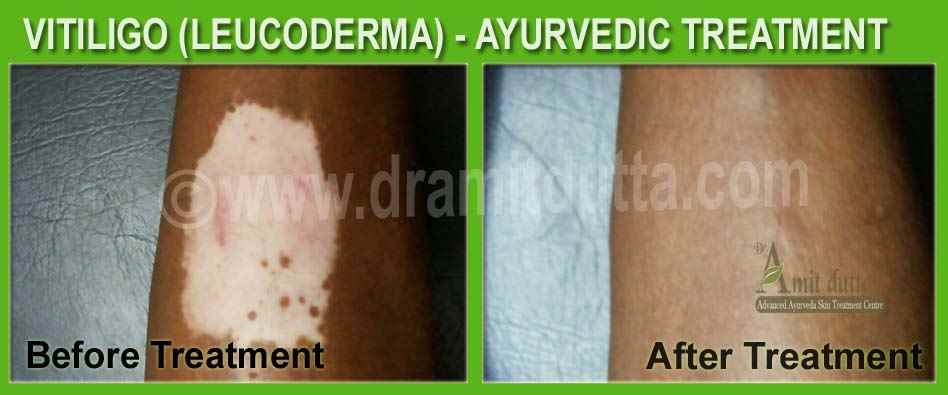 Svg Ayurvedam - Cover photo