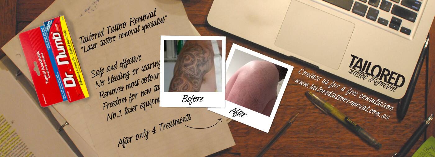 Tailored Tattoo Removal - Logo