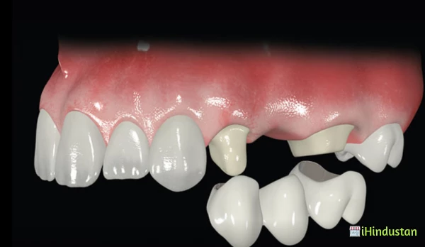 Thanjai Dental Centre,Root Canal Treatment - Logo