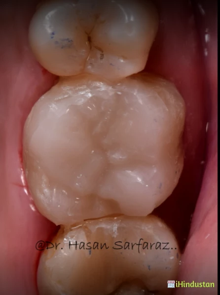 The Dentist - Dr Hasan Sarfaraz - Logo