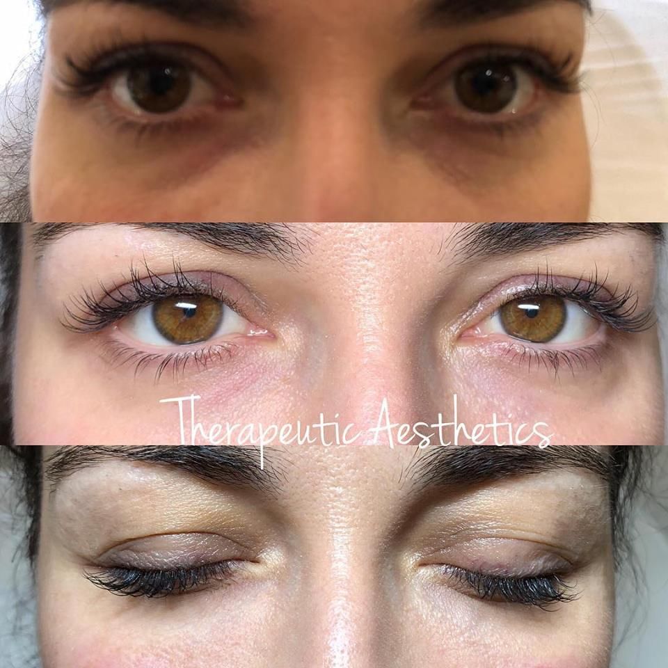 Therapeutic Aesthetics - Logo