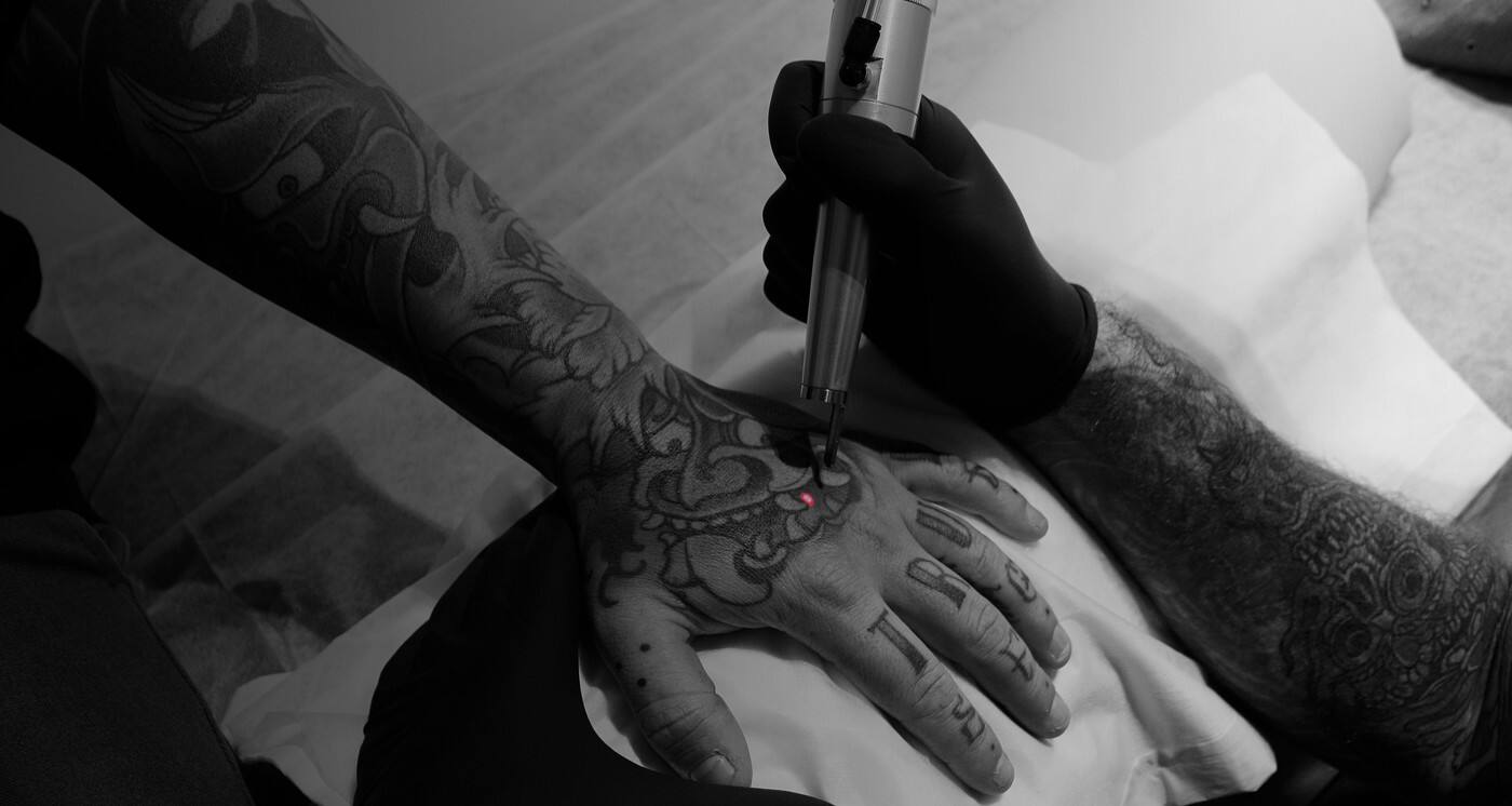The Tattoo Removal Co. - Cover photo