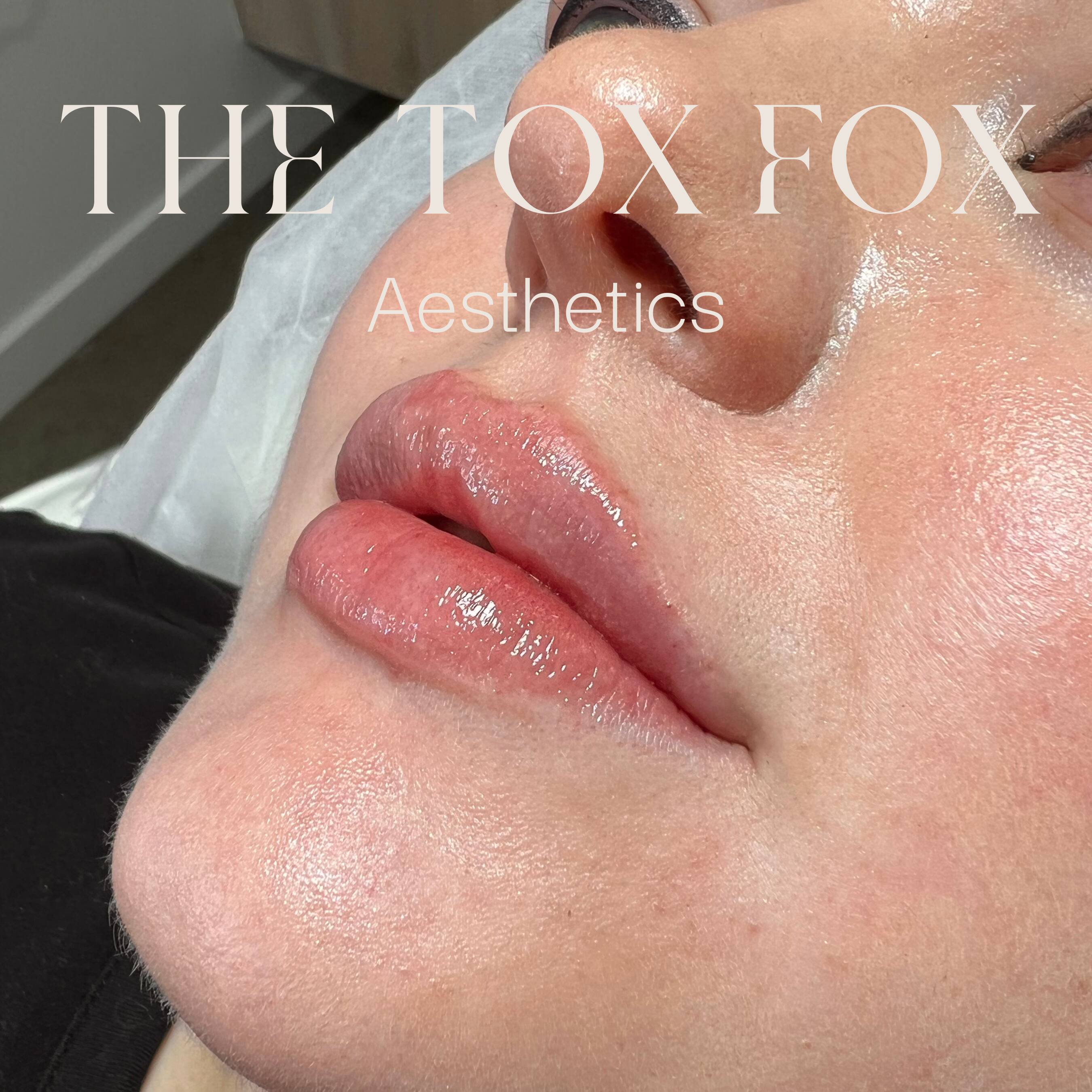 The Tox Fox Cosmetic Injectables - Cover photo