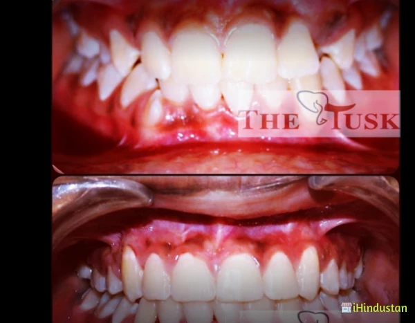 The Tusk Multispeciality Dental Clinic - Logo