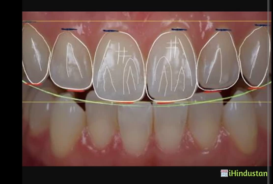 Trivandrum Smiles Multispecialty Dental Care - Logo