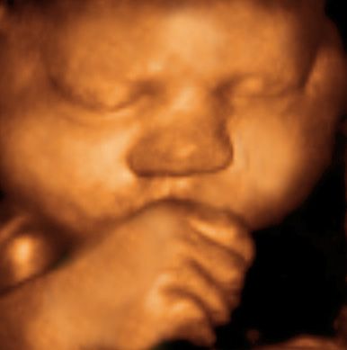 UC BABY 3D Ultra Sound - Logo