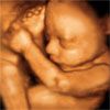 UC Baby 3D Ultrasound - Logo