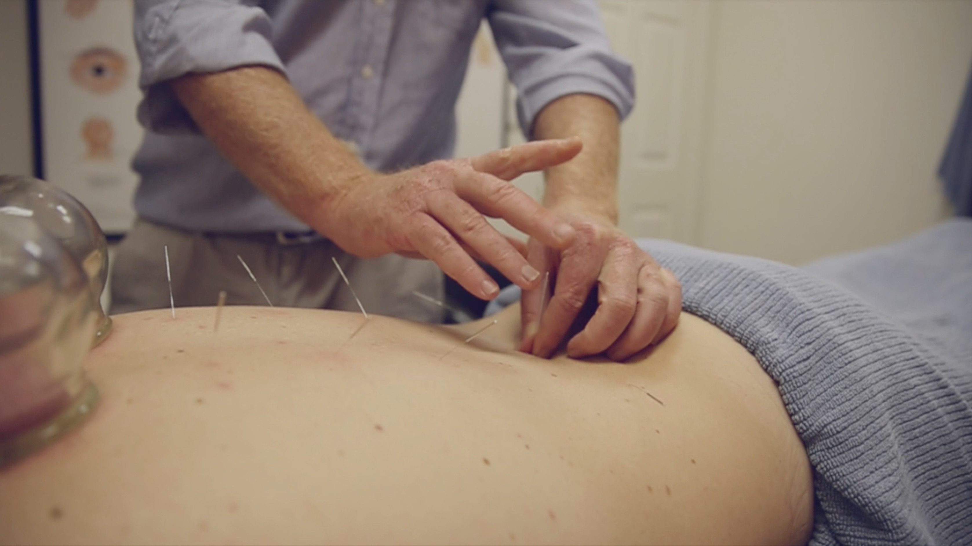 Upper Coomera Acupuncture - Logo