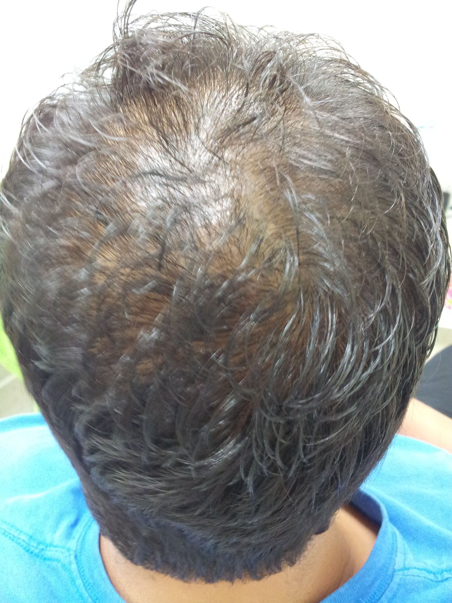 Uproot Hair Replication and Scar Solutions - Cover photo