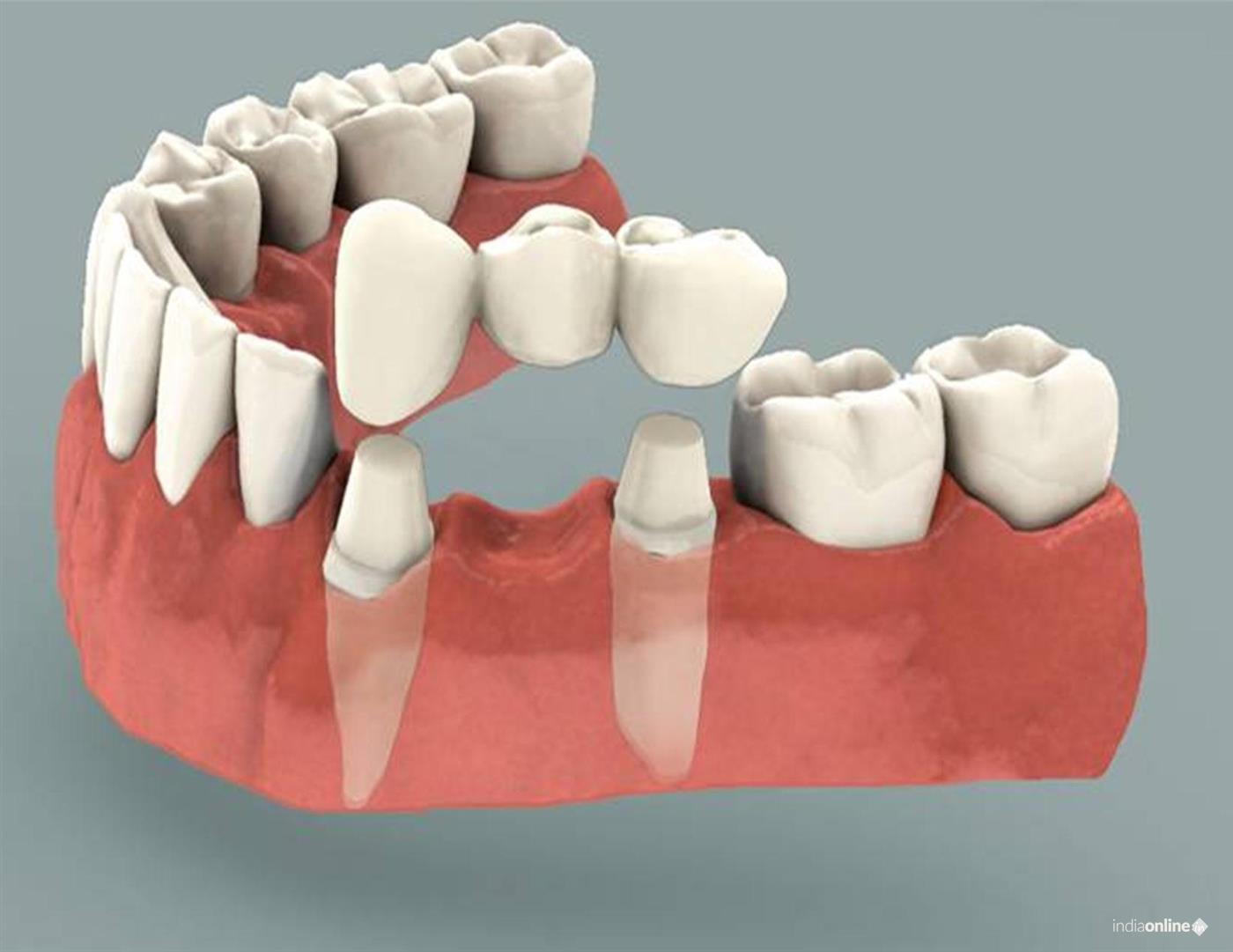 Vedatis Dental Hospital - Cover photo