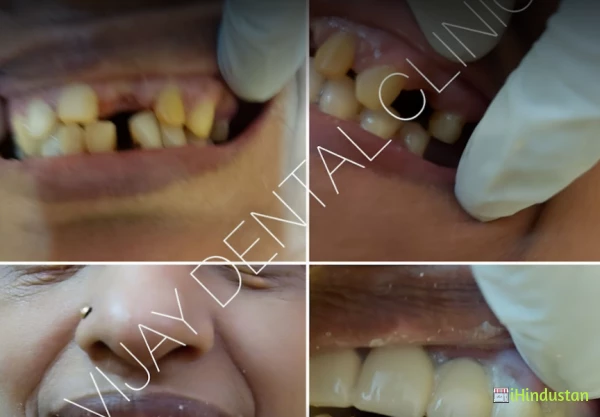 VIJAY DENTAL CLINIC - Logo