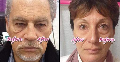 visalus - Cover photo