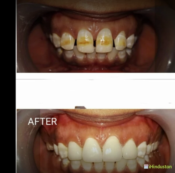WellCare Dental Clinic Gulbarga - Logo