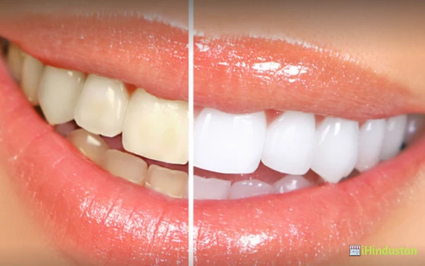YES DENTAL CARE - Logo